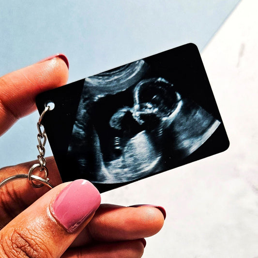 Personalised Baby Scan Photo Keyring
