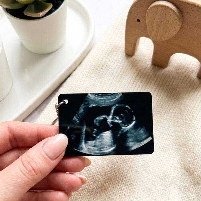 Personalised Baby Scan Photo Keyring